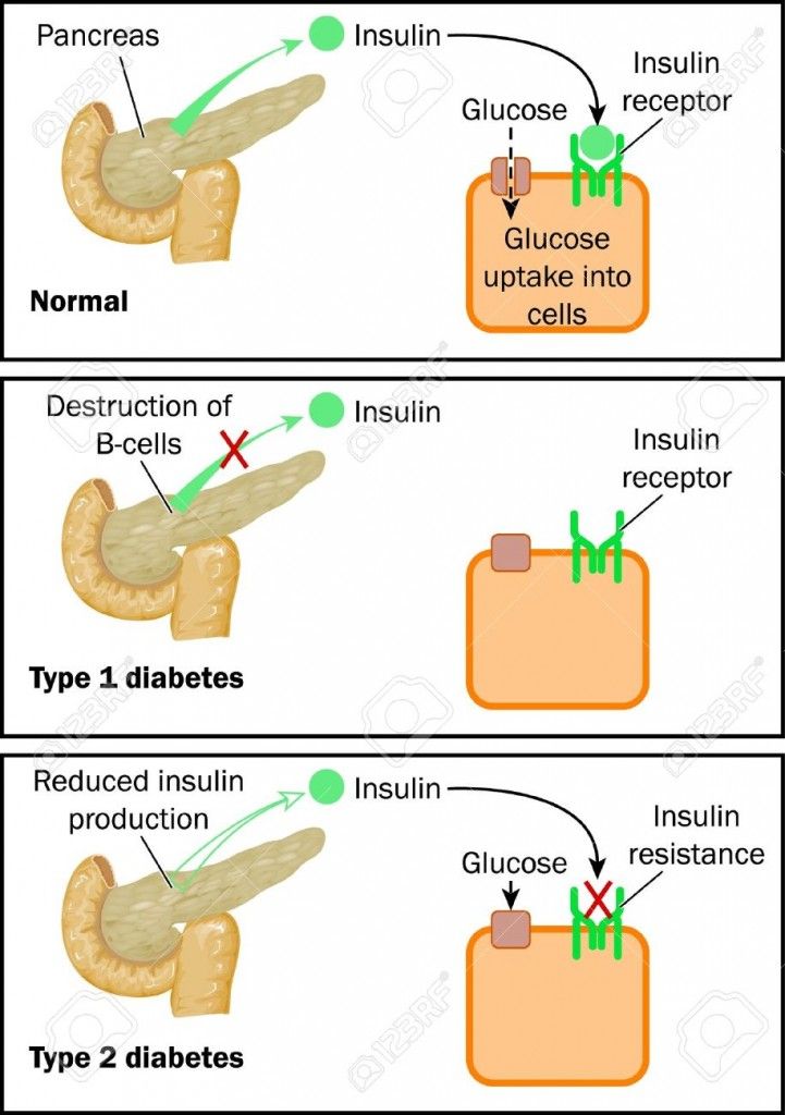 κανονική λειτουργία ινσουλίνης